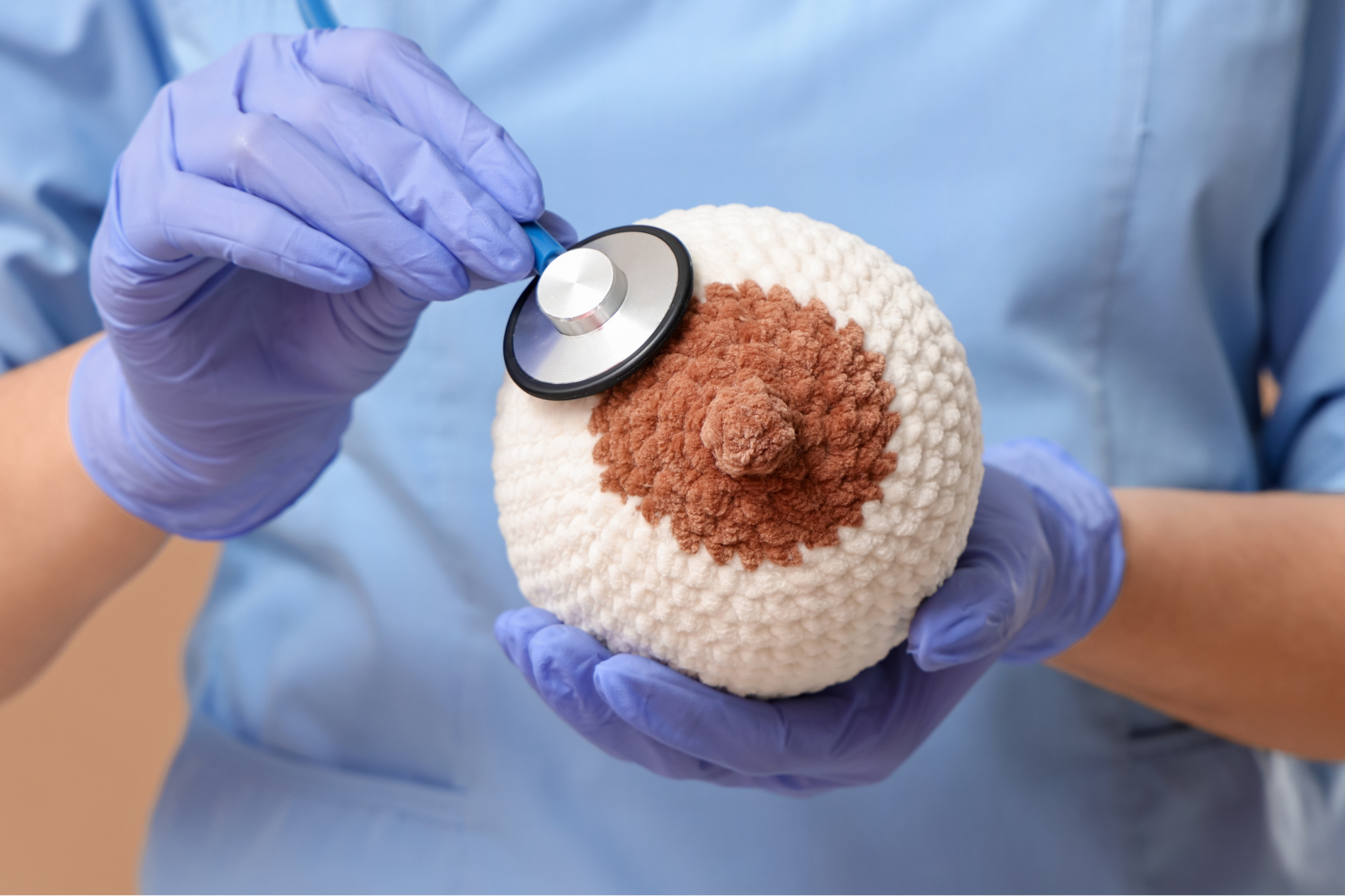 Casos de câncer de mama podem chegar a 3,5 milhões por ano até 2050, mostram estudos